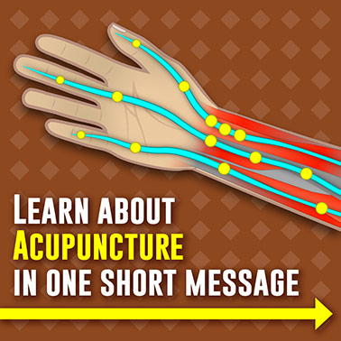 Acupuncture-Instagram-1