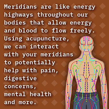 Acupuncture-Instagram-2