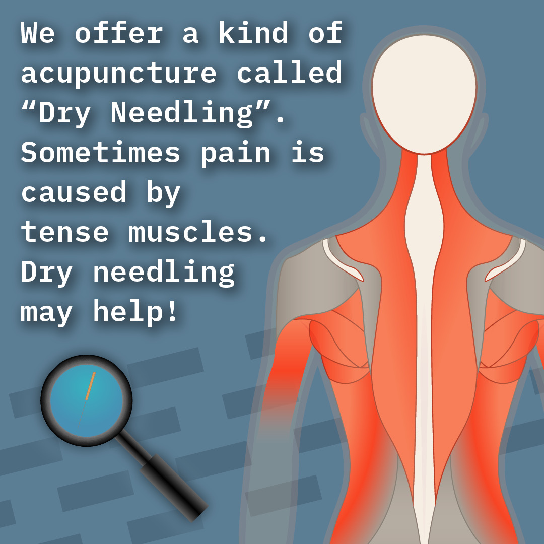 Dry-Needling-Instagram-2